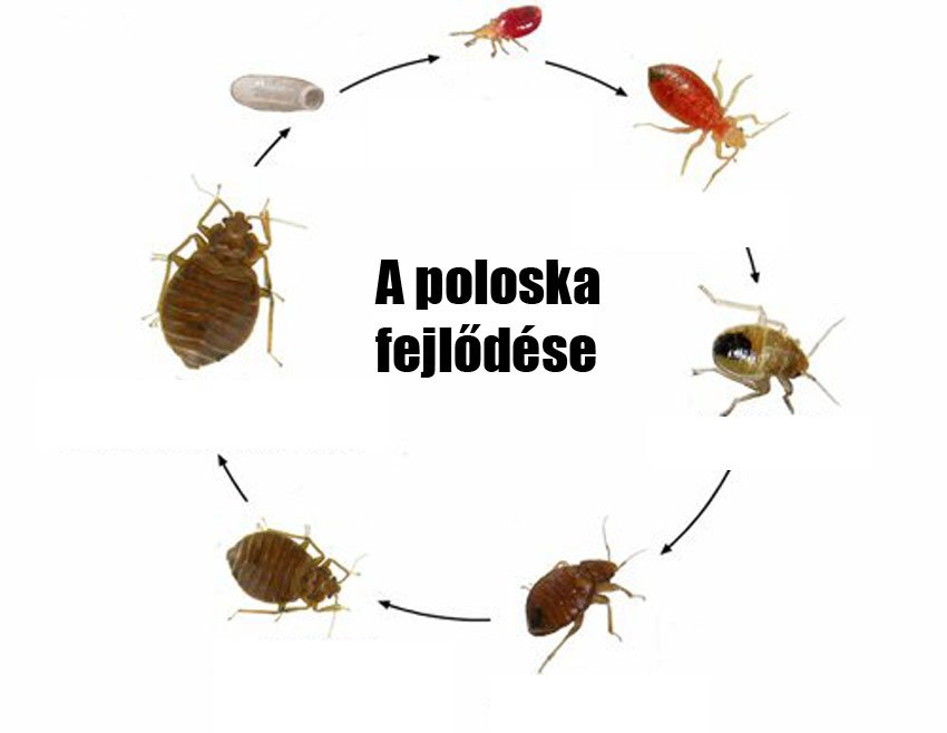 Czingerhome GREENFIRST® Anti Bettwanzen - Matratzenbezug mit Reißverschluss, abnehmbar (gegen Bettwanzen)